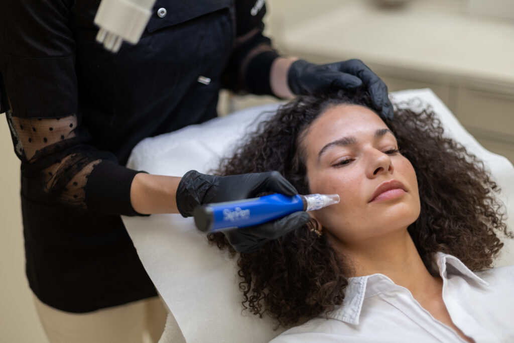 Biorevitalizácia: Kvalita pleti namiesto umelého objemu