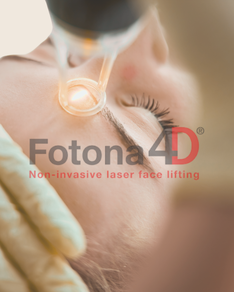 Fotona 4D Lifting – neinvazívny laserový lifting, omladenie a spevnenie pleti